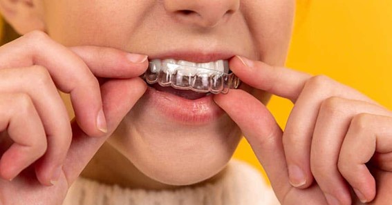 How To Make Retainer Fit Again